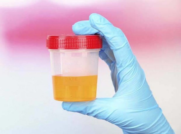 Test nosečnosti z urinom