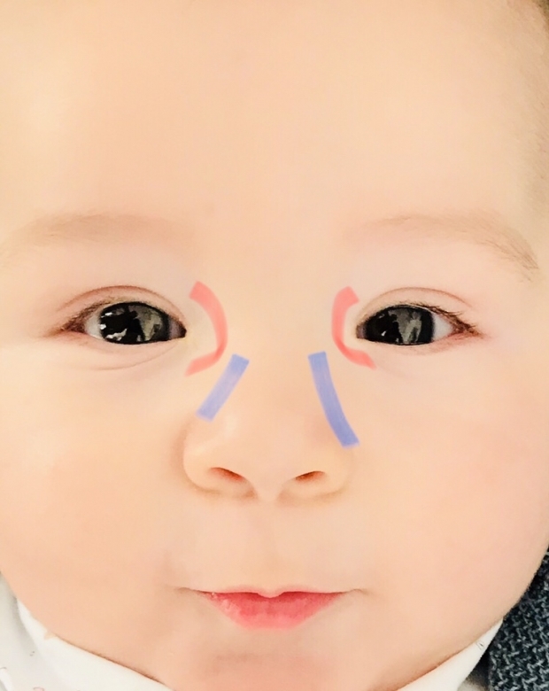 Masaža očesnega burrja pri dojenčkih