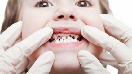 Poskrbite za zobozdravstveno oskrbo vašega otroka med semestrom!