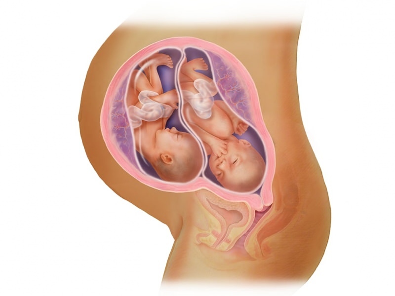 Nosečnost v IVF! Kaj je prenos zarodkov?