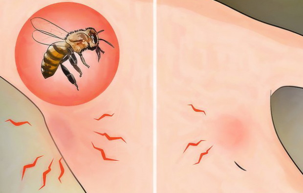 Kaj je alergija na čebele in kakšni so simptomi? Naravne metode, ki so dobre za čebelje pike