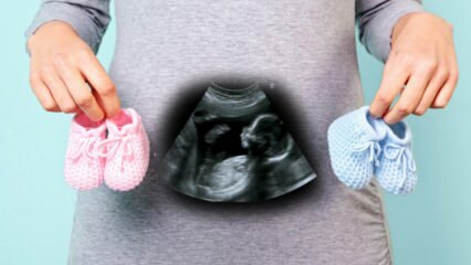 Ali bo spol otroka določen v prvem trimesečju nosečnosti?