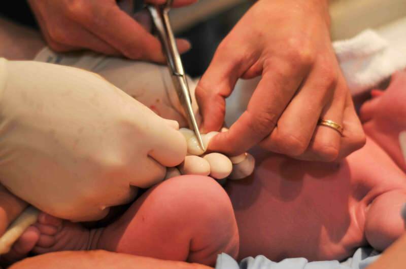 Kdaj je treba pri dojenčkih prerezati popkovino?
