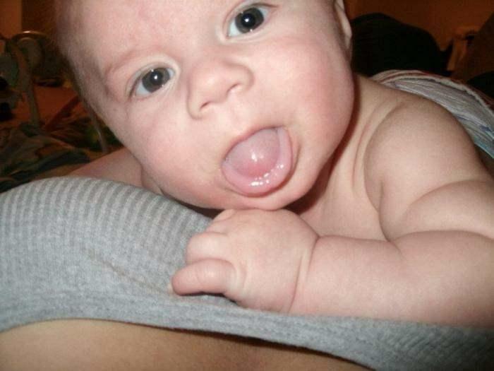 iztegnjen jezik pri dojenčkih