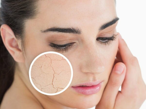 Zakaj se koža posuši? Kaj storiti na suhi koži? Najučinkovitejša priporočila za nego suhe kože