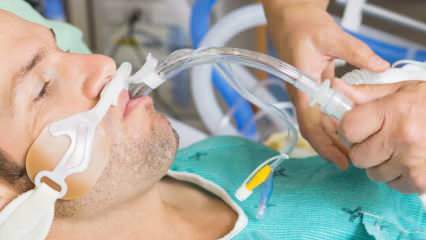 Kaj je Intubacija, ki jo je rekel Fahrettin Koca? Kaj pomeni intubirati pacienta? Se bo intubirani bolnik okreval?