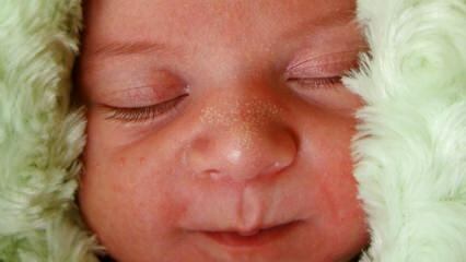 Zakaj se pri dojenčkih pojavijo bele pike?