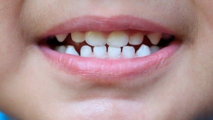 Kako otroke naučiti zobne nege?