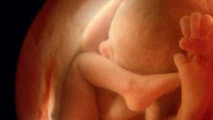 Na ultrazvoku ne prikazuje otrokovega spola! Kako dojenčki in deklice izgledajo na ultrazvoku?