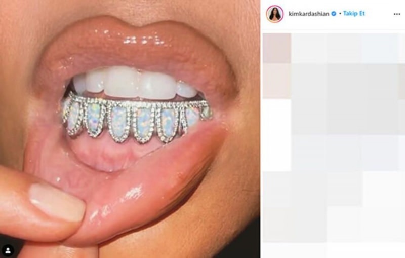 Zobni dragulj Kim Kardashian za 5000 dolarjev