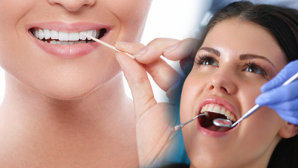 Kako ohraniti zdravje ustne votline in zob? Kaj je treba upoštevati pri čiščenju zob?