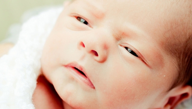Vzroki za nastanek brazgotin pri dojenčkih