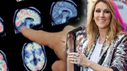 Kaj je sindrom togega človeka? Celine Dion