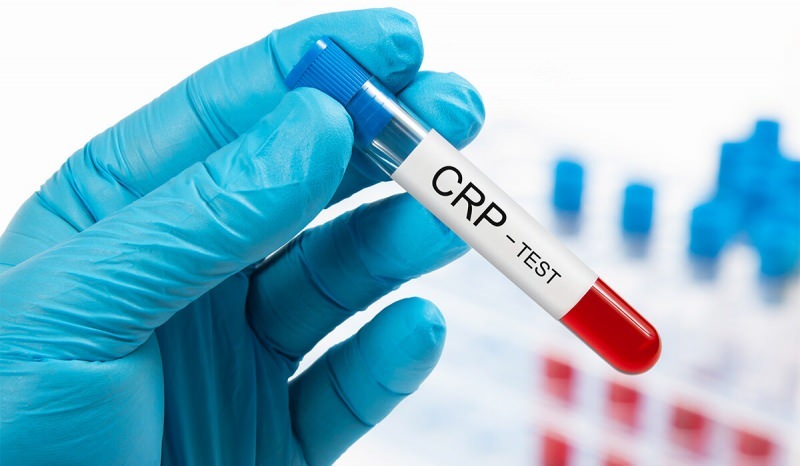 Zakaj CRP v krvi naraste? Kaj je CRP? Kako znižati CRP?