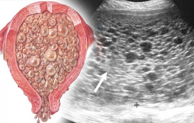 Kaj so grozdni nosečnostni simptomi nosečnosti z grozdjem