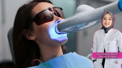 Kako poteka metoda beljenja zob (Bleaching)? Ali metoda beljenja škoduje zobem?