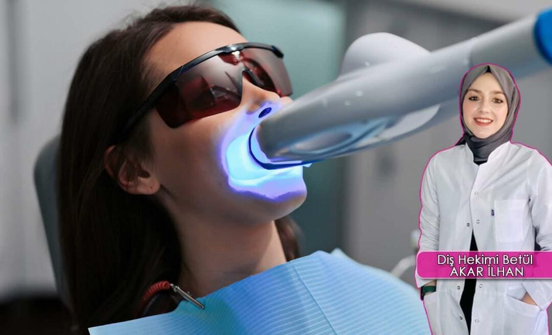 Kako poteka metoda beljenja zob (Bleaching)? Ali metoda beljenja škoduje zobem?