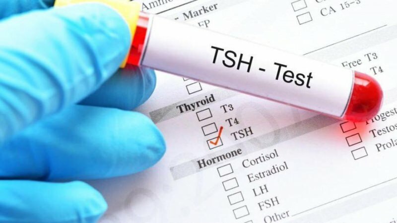 tsh test je hormonski test