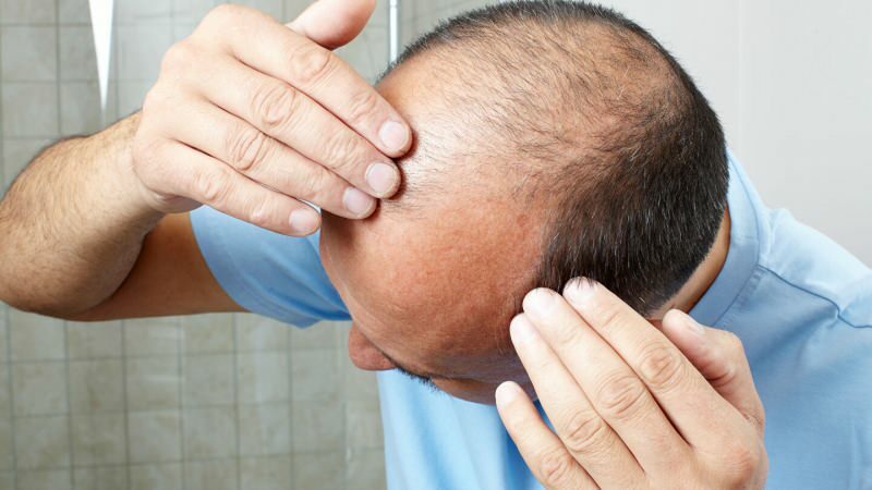 Ali presaditev las preprečuje ghusl?