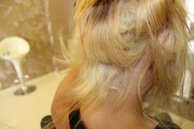 Kaj se naredi s pekočimi lasmi od sredine? Kako je treba vzdrževati zdravljene lase?