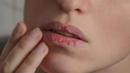 Kako skrbeti za ustnice doma? Enostavna 4-stopenjska nega suhih ustnic