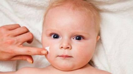 Nasveti za nego kože dojenčkov! Kakšne so težave s kožo pri dojenčkih?