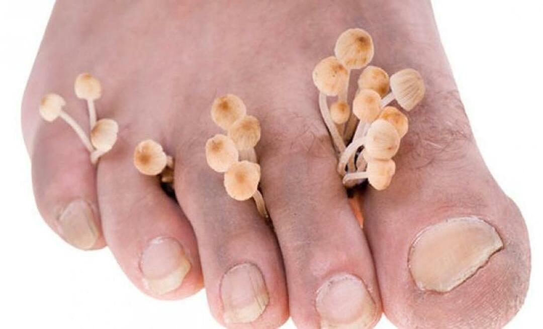 Kako se prenašajo glivice na nogah?