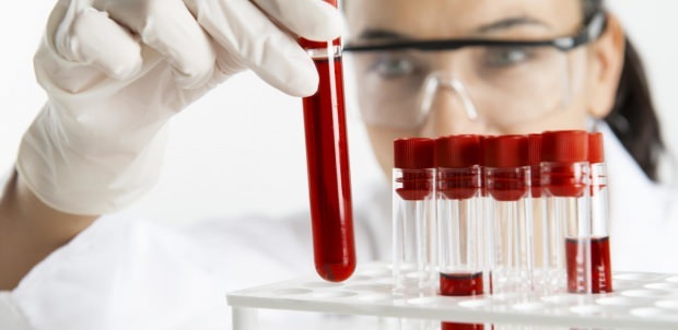 raven hemoglabina preverjamo s krvnim testom