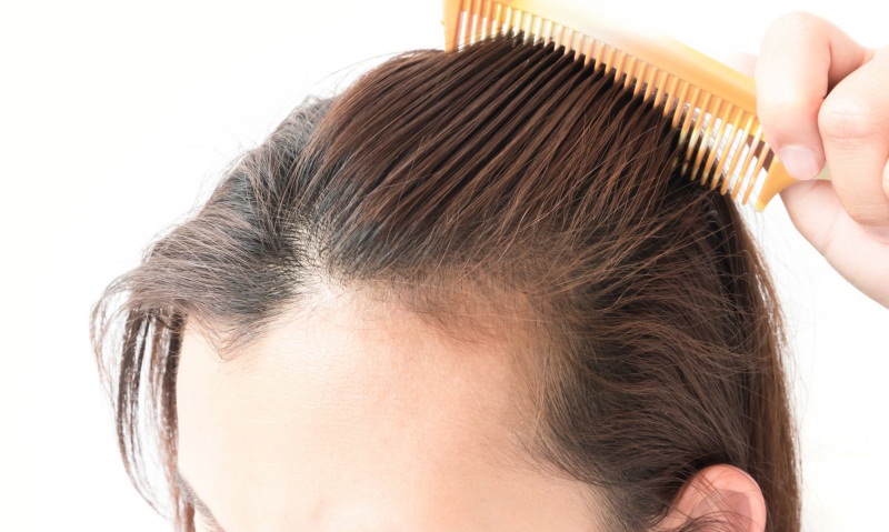 rešitve za izpadanje las po porodu! Kaj je dobro za izpadanje las?