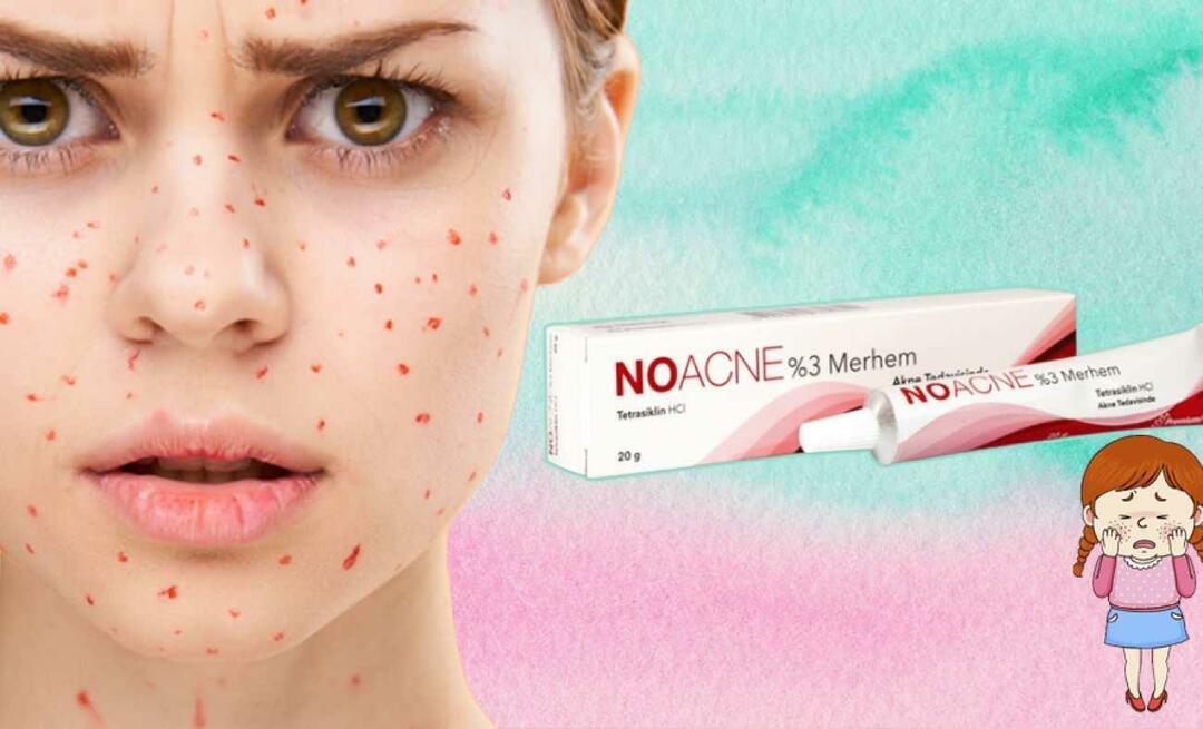 Kaj naredi krema (mazilo) Noacne? Kako uporabljati kremo Noacne? Cena kreme proti aknam 2023