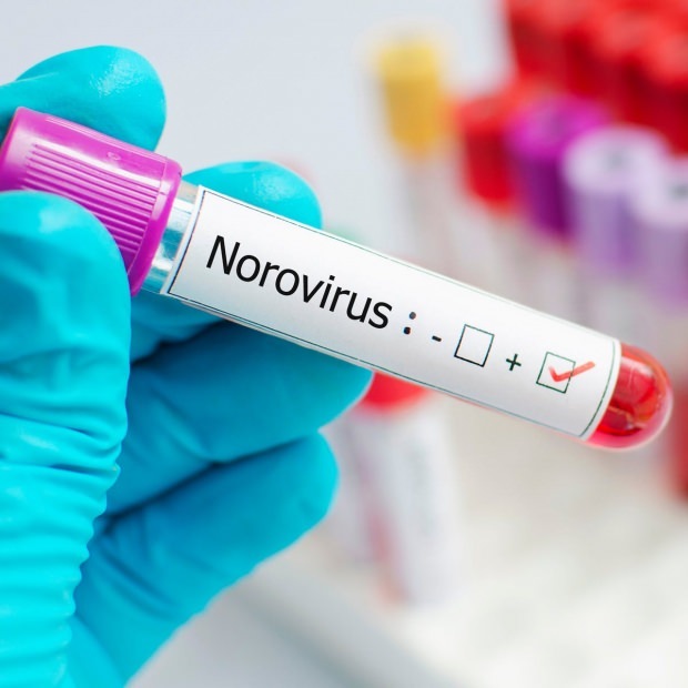 Kaj je norovirus in katere bolezni povzročajo