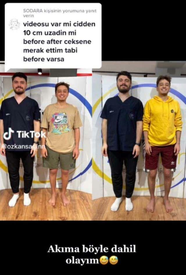 Özkan Sağın pred in po operaciji