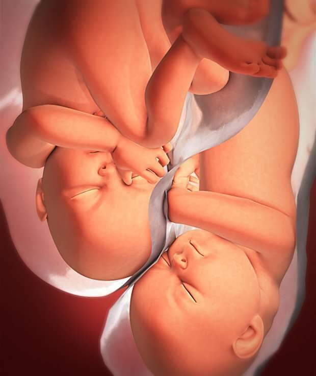 Kakšni so simptomi dvojne nosečnosti?