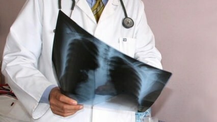 Napovedali so strokovnjaki! Povečanje smrti zaradi pljučnega raka
