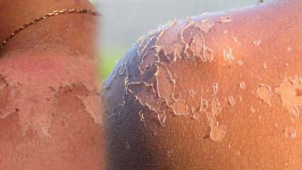 Kaj je dobro za piling kože in kako je piling kože? Domače sredstvo za piling kože