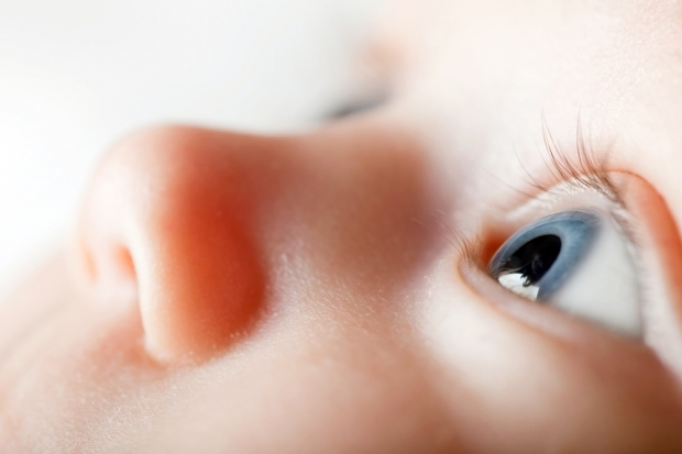 Kaj povzroča brazgotine pri dojenčkih?