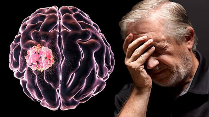Tkivo, ki nastane v možganih zaradi motenj celičnih struktur, se imenuje tumor.