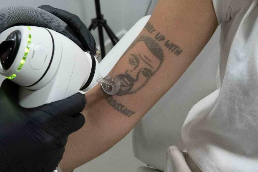 V Londonu bodo brezplačno odstranili tetovažo Kanyeja Westa 