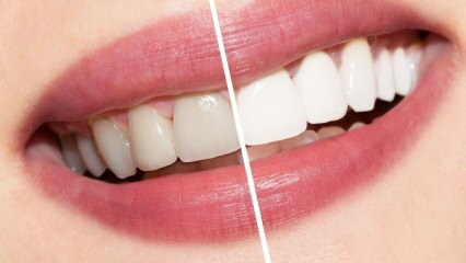 Kakšna so priporočila za bele zobe? Beljenje zob naravno zdravi doma ...