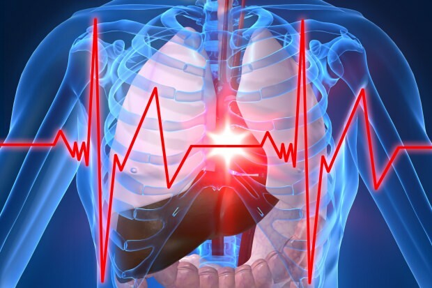 kakšni so simptomi srčnega infarkta
