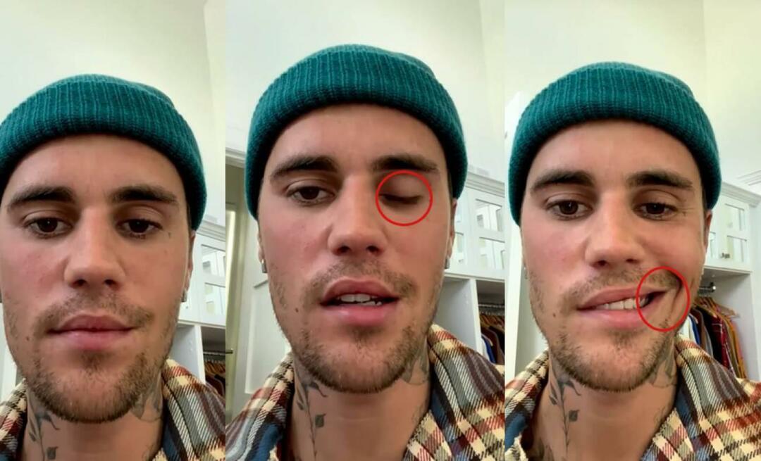 Justin Bieber je imel paralizo obraza! Slavni zvezdnik se ne more več odpraviti na svetovno turnejo