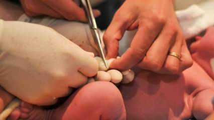 Kdaj se pri dojenčkih prereže popkovina? Prednosti poznega prereza popkovnice