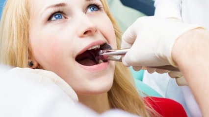 Ali je odstranjevanje zob med nosečnostjo?