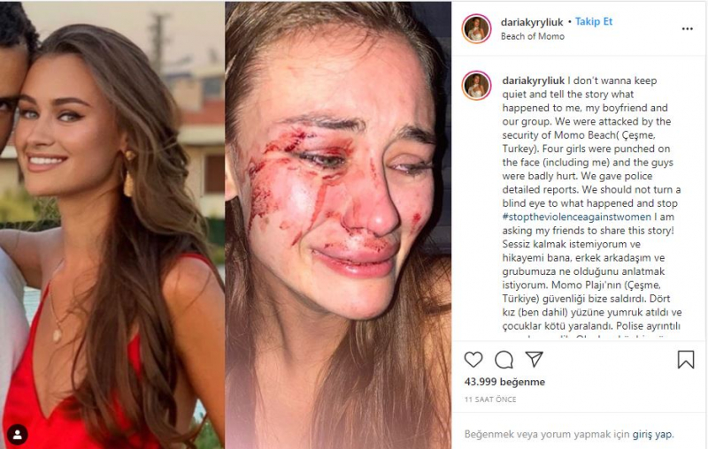 Daria Kyryliuk, manekenka, ki so jo pretepli v İzmir Çeşme, je ujela koronavirus!