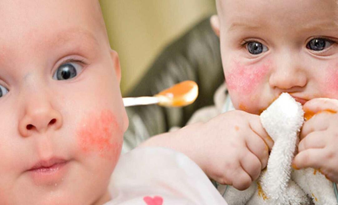 Kaj naj jedo dojenčki z alergijami? Kakšna so alternativna živila za alergične dojenčke?