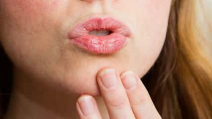 Kako negovati ustnice doma? Enostavna nega suhih ustnic v 4 korakih