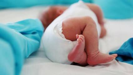 Ali naj imajo dojenčki ultrazvok kolka?