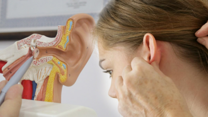 Kaj je kalcifikacija ušes (otoskleroza)? Kakšni so simptomi kalcifikacije ušes (otoskleroza)?