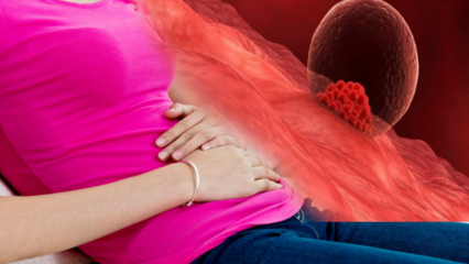 Kaj je implantacijska krvavitev med nosečnostjo? Kako ločiti implantacijsko krvavitev od menstrualne